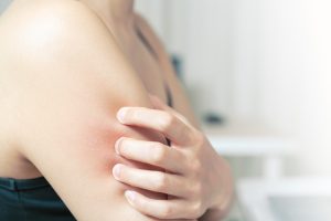 身體乳止癢有效嗎？人氣商品推薦，讓你皮膚不再乾癢！